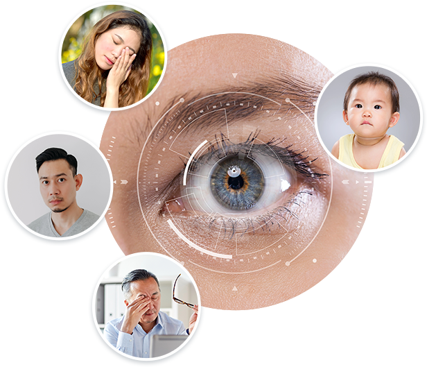 sunmed cataract