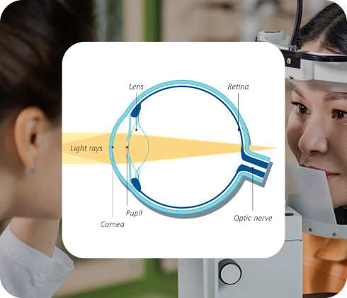 sunmed Presbyopia