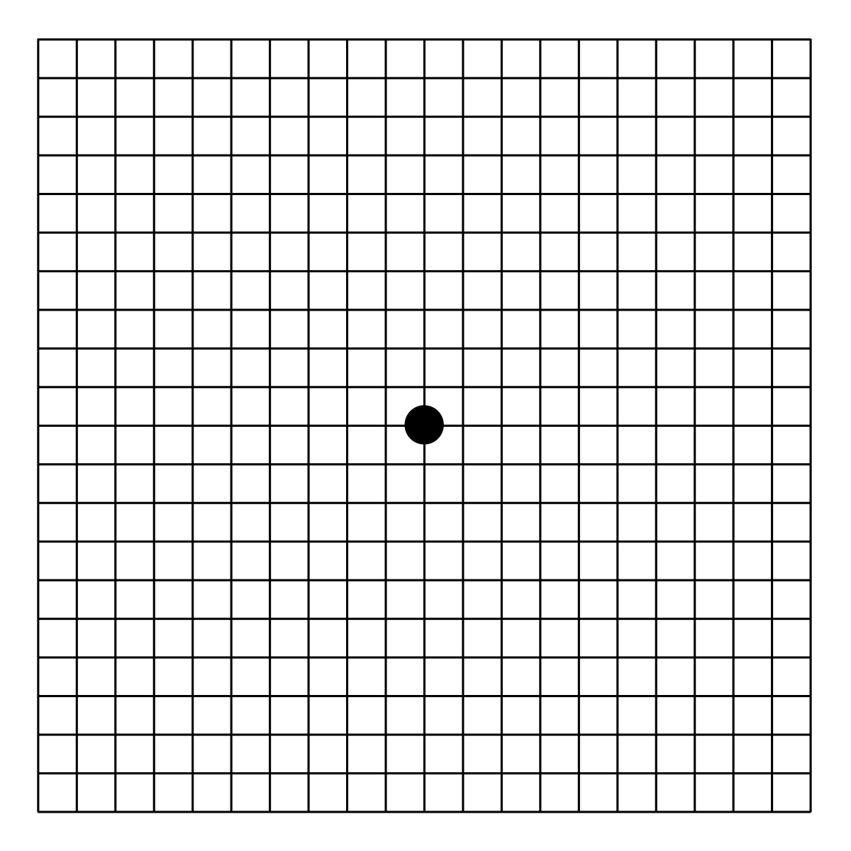 Age-related Macular Degeneration